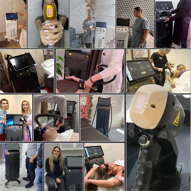 4-Wave 3000 W Diode Laser Hair Removal System manufacturers