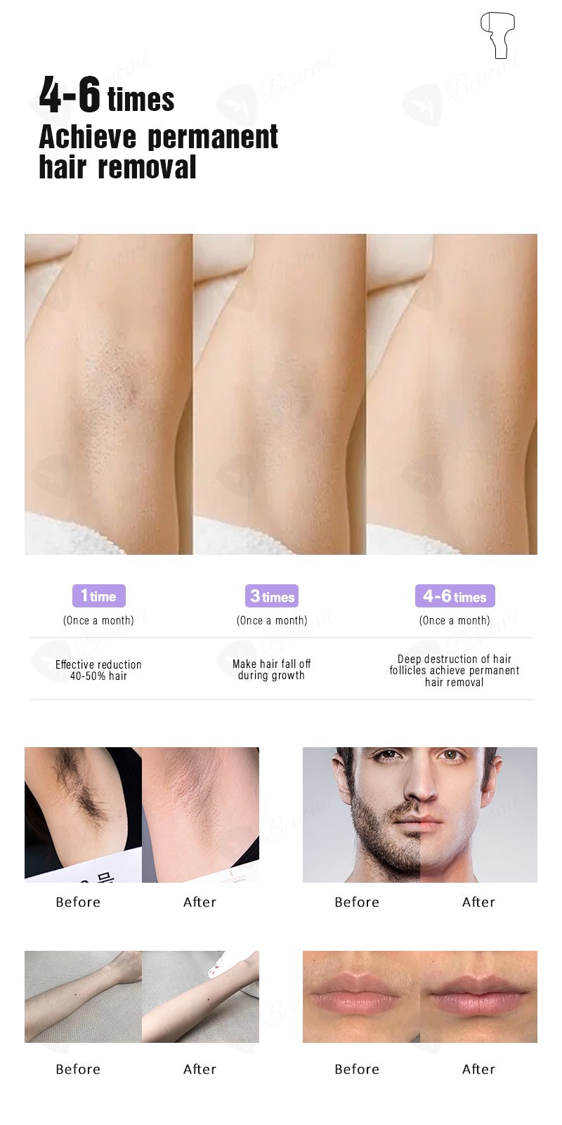 Course of treatment Course of treatment