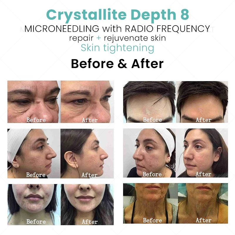 25516---2 25516---2